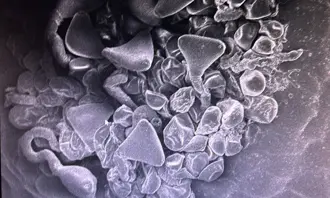 An electron microscope photo of the tip of a macadamia flower showing pollen starting to germinate