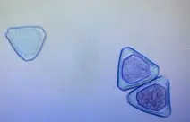 Pollen stained for viability, the left pollen is not viable and the two one the right is viable.